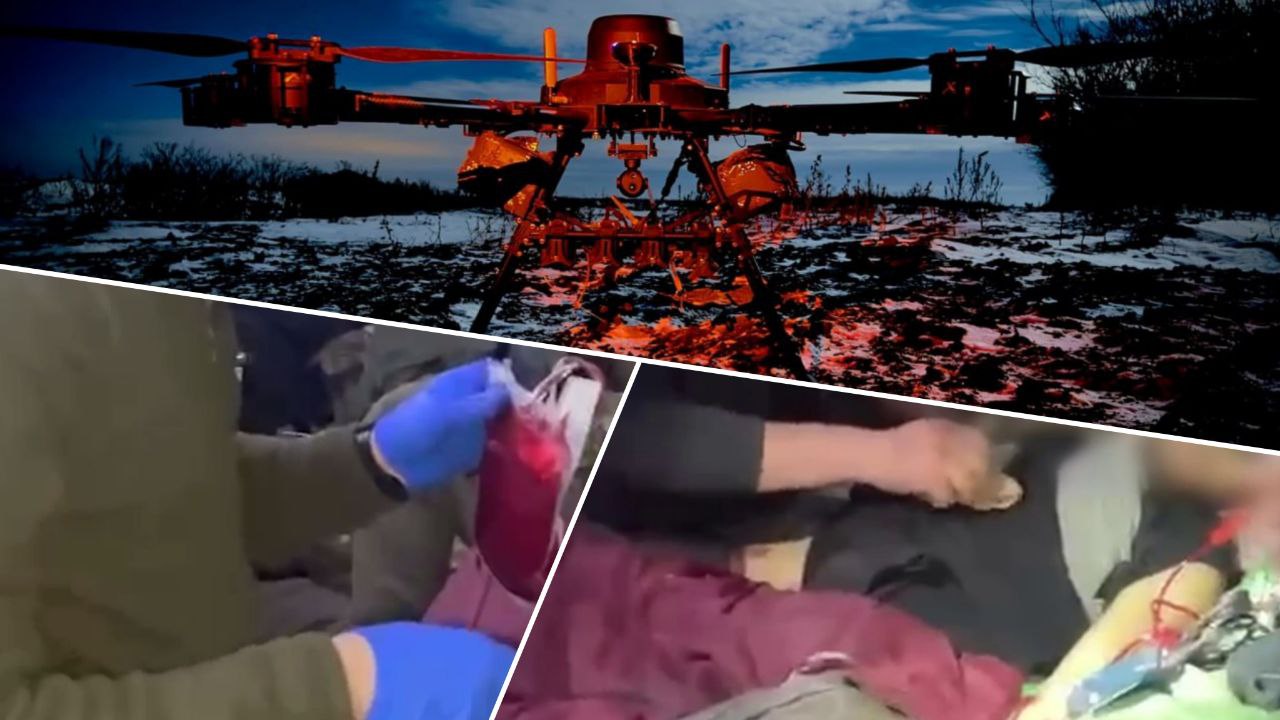 Гвардійці зробили переливання крові бійцеві просто під час бою