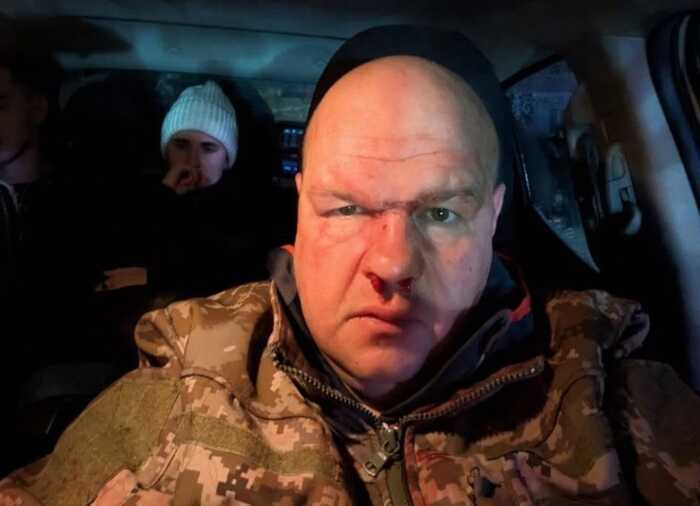 Майора ЗСУ побили молодики після ДТП: на місце прибув підполковник ТЦК, який намагався залякати потерпілого